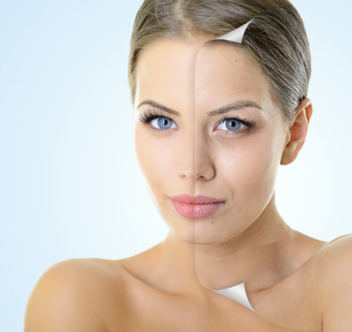 What is Dermaplaning